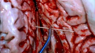 Время вышло